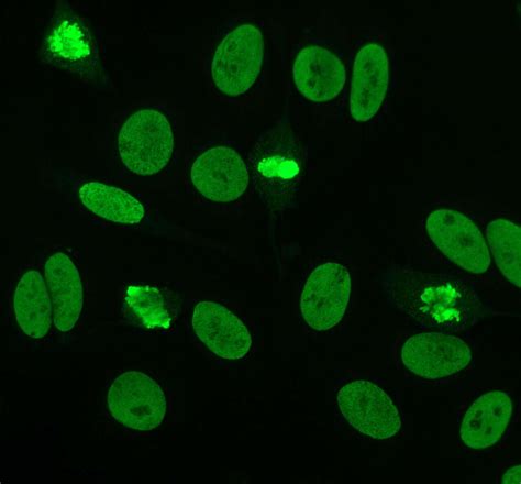 Antinuclear Antibodies Ana