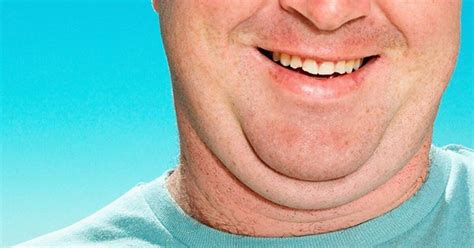 Say Goodbye To Double Chin 5 Effective Strategies For A Perfect Jawline