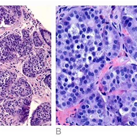 A Terminal Ileum Biopsy Revealed Uniform Cells Arranged In Organoid Download Scientific