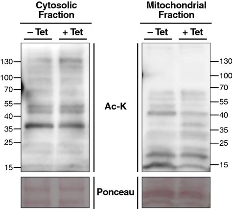 Overexpression Of Mt ELP3 Does Not Affect Mitochondrial Protein