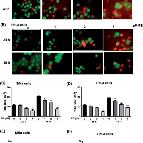 Effect Of Plumbagin Pb On Cell Migration Of Siha Cells Wound Healing