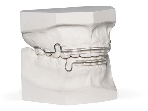 Wrap Around Retainer