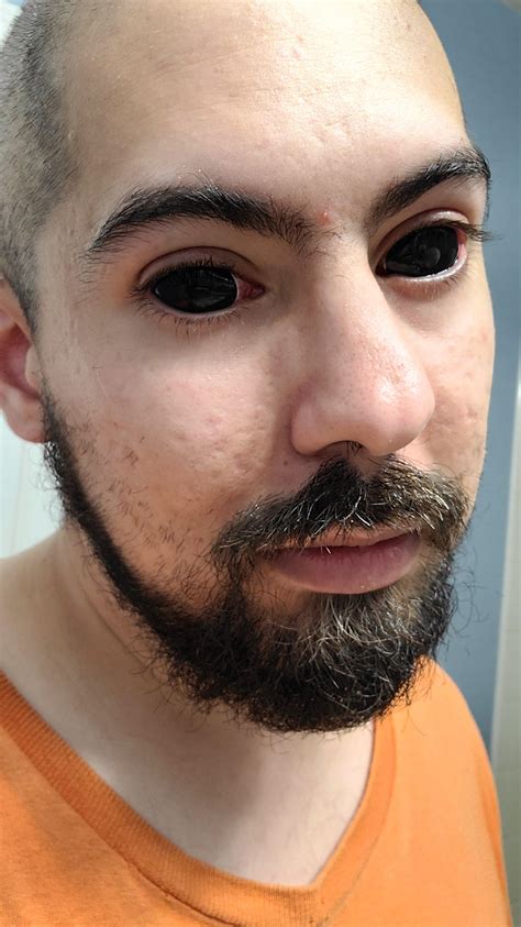 Got my first pair of costume scelara contacts. I'm used to wearing