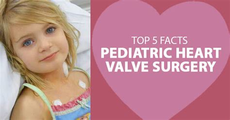 Pediatric Heart Valve Surgery Top 5 Facts