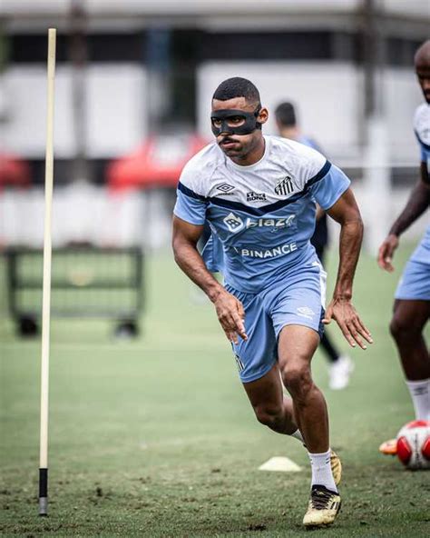 Joaquim fratura nariz em jogo do Santos e deve jogar clássico de