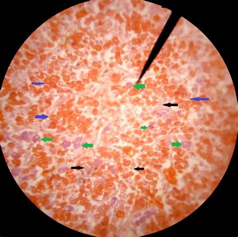 The Distal Of Anterior Pituitary X40 Most Of Cell Is Orange Acidophils