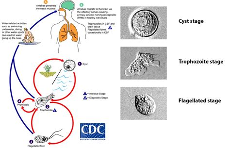 Naegleria Fowleri Characteristics Life Cycle And Lab Diagnosis Microbe Online