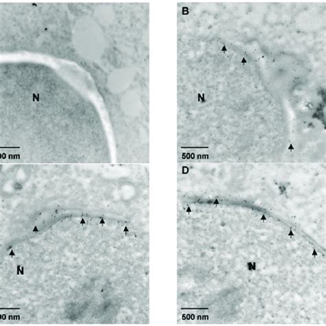 Immunoelectron Microscopic Localization Of Mouse Rcbtb2 Three