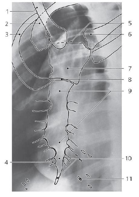 Sternum, oblique x-ray Diagram | Quizlet