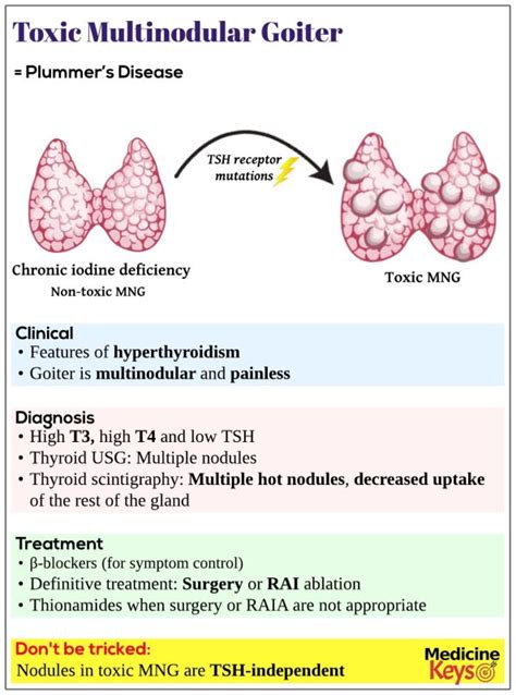 Toxic Multinodular Goiter Mng Medicine Keys For Mrcps