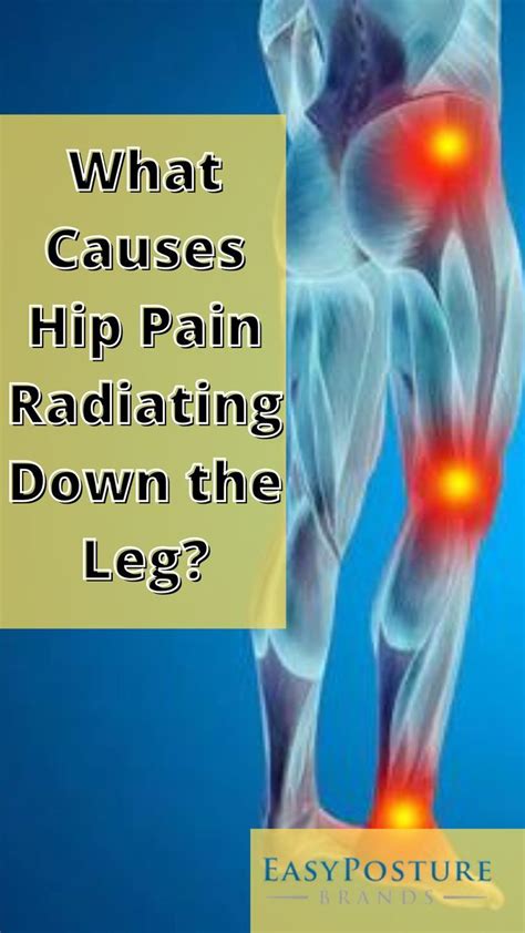 What Causes Hip Pain Radiating Down The Leg One Of The Most Common And