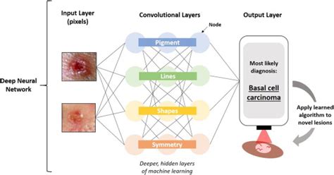 Artificial Intelligence In The Detection Of Skin Cancer Journal Of