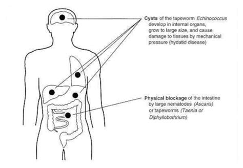 Parasitic Gi Infections Flashcards Quizlet