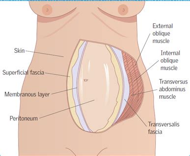 Obligate Value Medic C Section Layers Of Skin Perturbation Remember