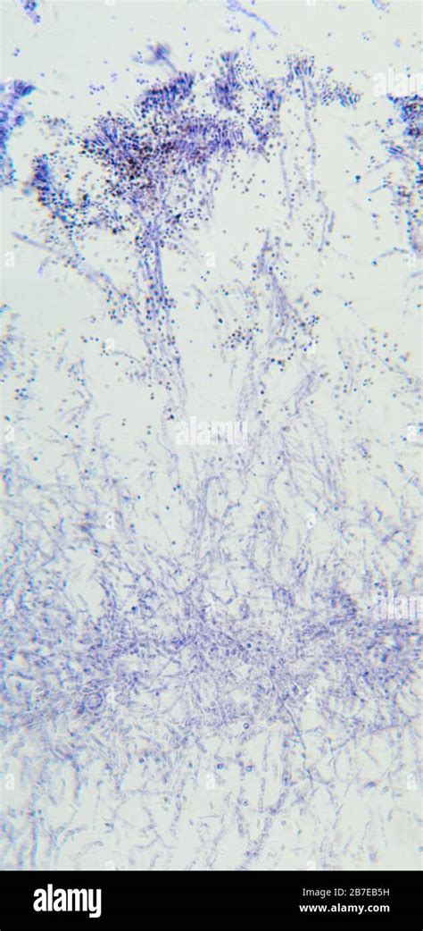 Penicillium Hongos Ascomicetos Detalle Bajo El Microscopio Para Los