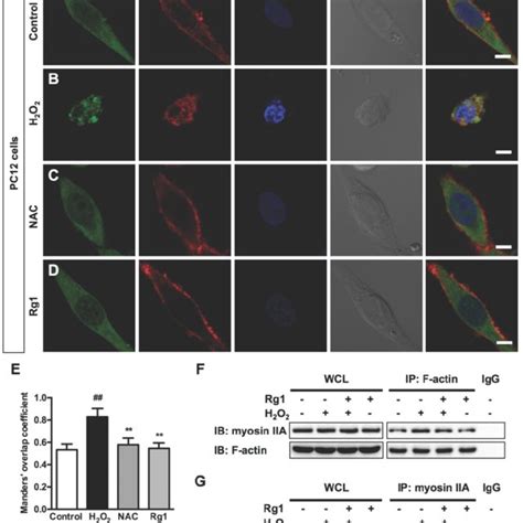 Protective Effects Of Rg1 On H2o2 Induced Apoptosis In Pc12 Cells And