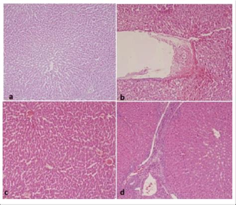 A Normal Liver Tissue In The Control Group B Histopathological Download Scientific Diagram