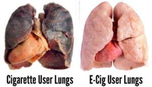 Vaping vs. Smoking