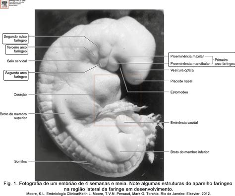 Cap 8 Aparelho Faríngeo Aparelho Branquial Embrionhands