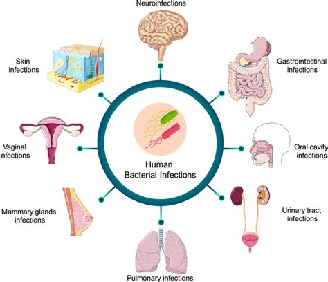 Bacterial Infection Picture