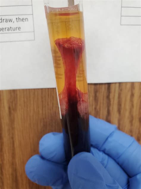 Fibrin Blood Clot