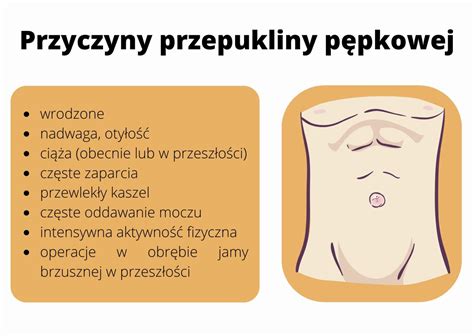 Przepuklina P Pkowa Leczenie Sposoby