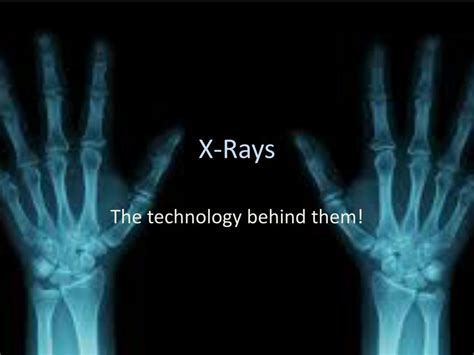 Ppt X Rays Powerpoint Presentation Free Download Id1840805