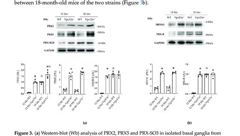 A Western Blot Wb Analysis Of Prx2 Prx5 And Prx So3 In Isolated Ba