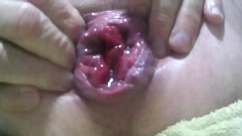 Prolapse Audio XVIDEOS