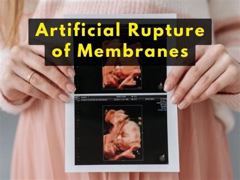 The Ultimate Guide To Artificial Rupture Of Membranes In 2023