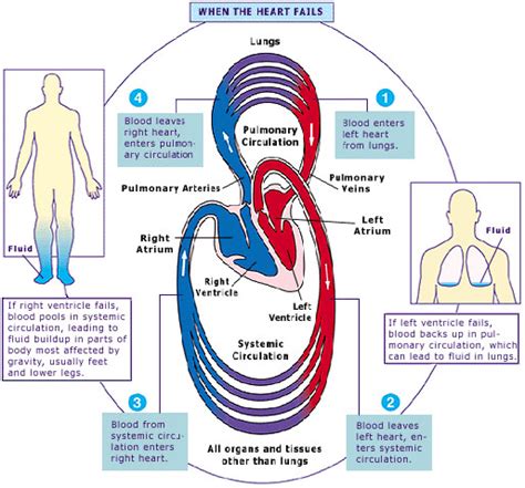 Heart Failure Diagram