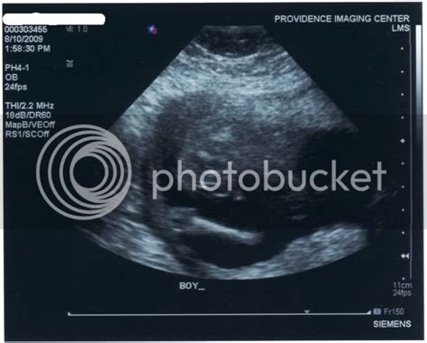 Boy ultrasound pics | BabyCenter