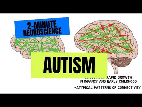 What Part Of The Brain Is Affected By Autism Here On The Spectrum