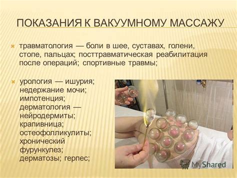 Вакуумный массаж спины: показания и противопоказания