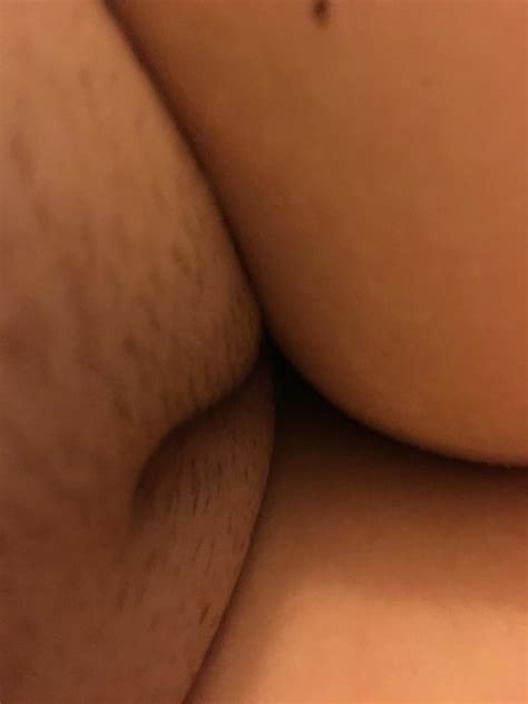 Skin Close Up Cheek Abdomen Porn Pic