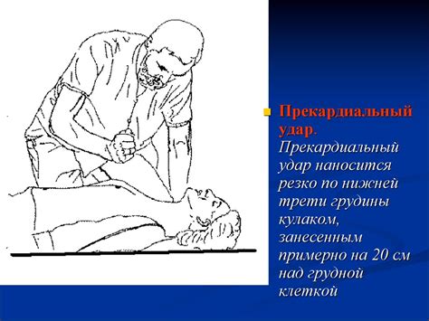 Явления шока - презентация онлайн