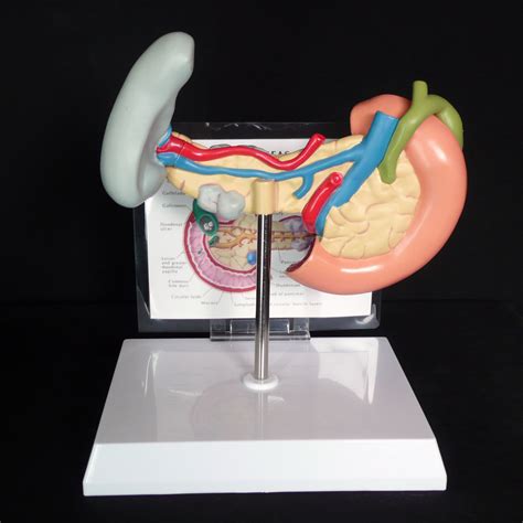 Anatomical Human Pancreas Spleen And Gallbladder Pathological Diseases