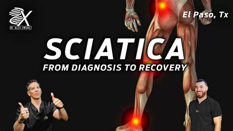 From Diagnosis To Recovery Navigating Sciatica With Chiropractic Care