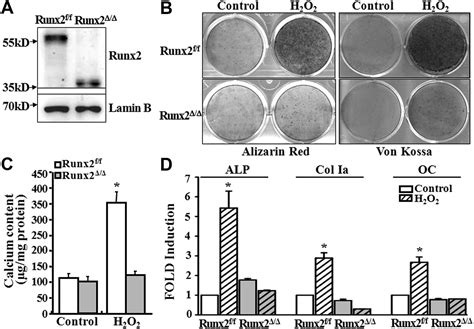 Smooth Muscle CellSpecific Runx2 Deficiency Inhibits Vascular