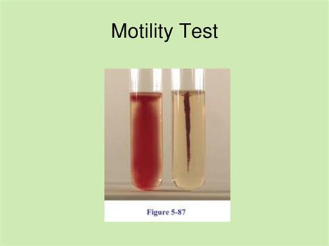 Ppt Microbiology Unknown Lab Powerpoint Presentation Id167204