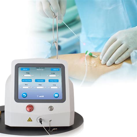 Minimally Invasive Evlt Varicose Veins Laser Nm Ablation Therapy