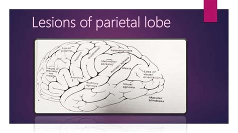 Parietal lobe it's lesions and orbital nerve pathway and it's lesions