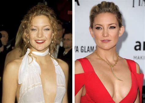 Top 10 Female Celebs With The Most Expensive Breast Implants With Pictures Page 7 Of 10