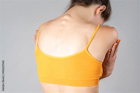 Intervertebral Spine Hernia Pain Between The Shoulder Blades Woman