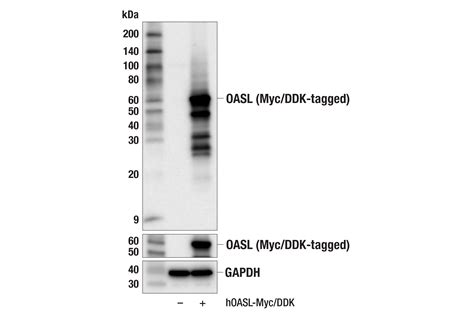 OASL E7W1R Rabbit MAb Cell Signaling Technology