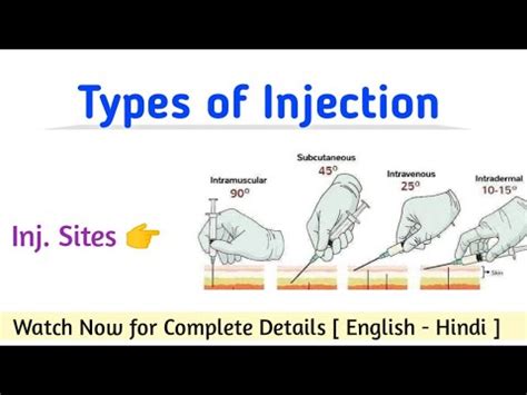 Types Of Injection Injection Sites Injections IV IM ID