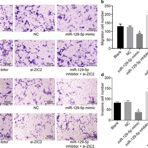 Overexpressed Mir 129 5p Or Silencing Zic2 Inhibits Pca Cell Migration