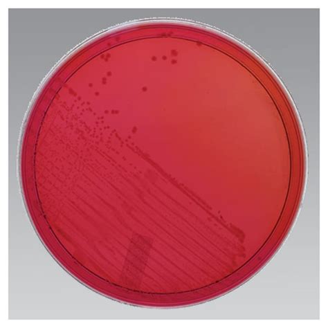 Xld Agar E Coli