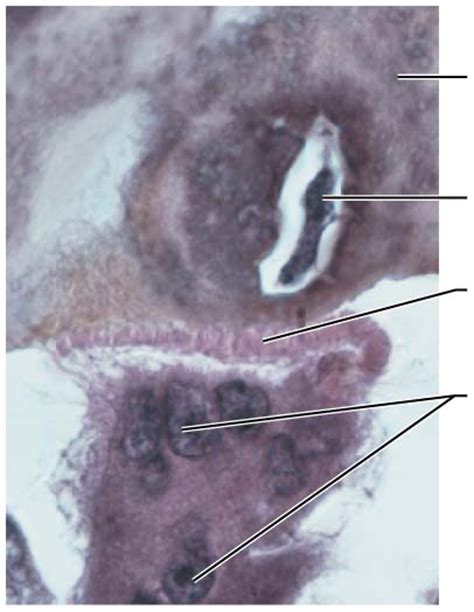 Osteoclast Diagram | Quizlet 