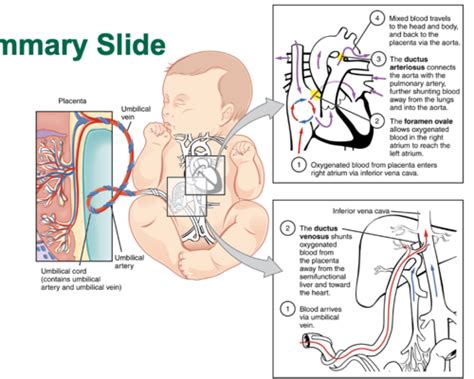 7 Cardiology Peds Clin Med Flashcards Quizlet